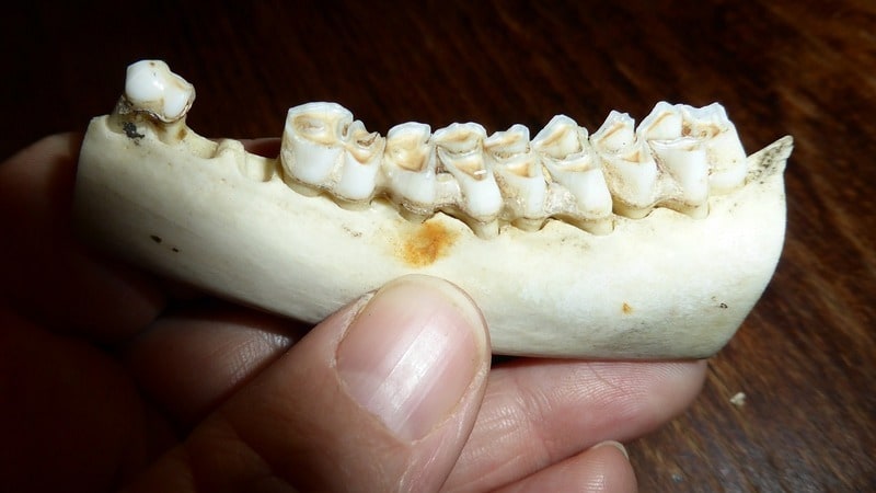 jaw bone with missing teeth